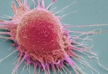 Tabaco, infecciones y alcohol: Los tres enemigos que causan el 40% del cáncer global