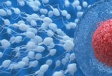 Detectan el primer caso de transmisión de una enfermedad rara por donación de esperma