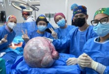 Extraen tumor de más de 25 kilos en Anzoátegui