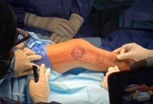 Realizan en el Humnt cirugía ortopédica que solo se hacía en Caracas