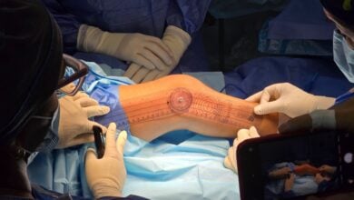 Realizan en el Humnt cirugía ortopédica que solo se hacía en Caracas