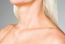 Cómo suavizar las arrugas del cuello naturalmente