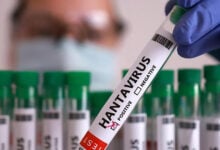 ¿Cómo se contagia el hantavirus? La OMS explica los riesgos tras el brote en el crucero
