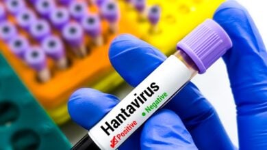 Mortalidad por hantavirus entre adolescentes alcanza el 50 %, según un nuevo estudio