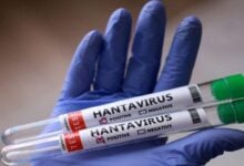 Infectóloga explica la diferencia entre el hantavirus de Venezuela y el de Argentina tras muertes reportadas