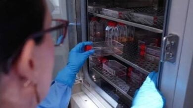 Científicos usan "tijeras moleculares" para eliminar el ADN del VIH con un 97 % de efectividad