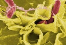 Reino Unido investiga brote de salmonelosis con posible origen en productos de Ucrania