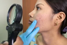 Sociedad dermatológica rechaza contenido de influencers sobre área de salud