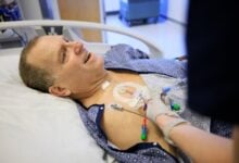 Un hombre vive nueve meses sin diálisis gracias a un riñón de cerdo modificado