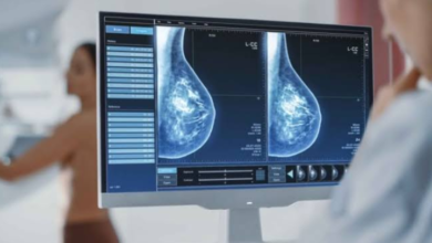 Venezuela cuenta con 70 centros oncológicos para atender el cáncer de mama