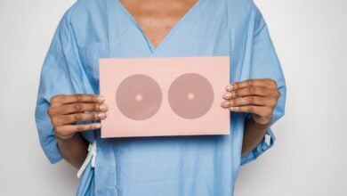 El alto costo económico del cáncer de mama y los avances médicos en Monagas